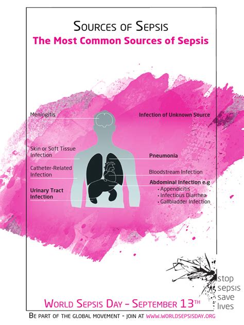 Sepsis Awareness Poster - Sources Pink | PDF