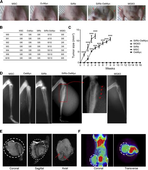 Intraosseous Tumor Formation By SiRb OeMyc Cells In Nude Mice A