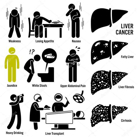 Liver Cancer Symptoms Causes Risk Factors Stick Figure Pictogram Icons Stock Vector By ©leremy