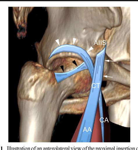 An Anatomical Study Of The Indirect Tendon Of The Rectus Femoris Using