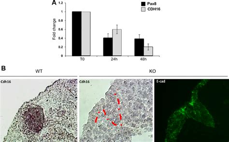 Silencing Of Pax Affects Cadherin Expression Both In Vitro And In