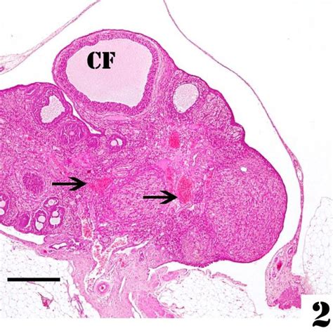 Section In Ovary Of A Rat Treated With Ga3 For 8 Weeks Showing