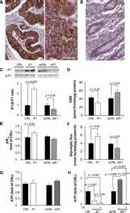 The Mitochondrial Atpase Inhibitory Factor 1 Triggers A Ros Mediated