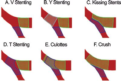 Coronary System Tutorial Biomedical Application Of The Coronary