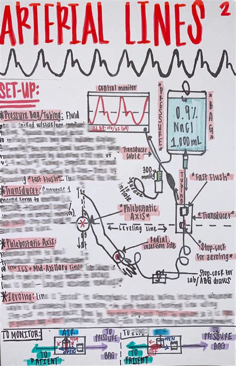 Arterial Line ICU Nurse Reference Sheet Etsy