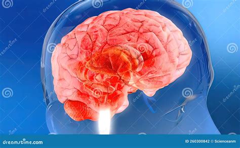 Sacral Nerve Stimulation Also Known As Sacral Neuromodulation Stock