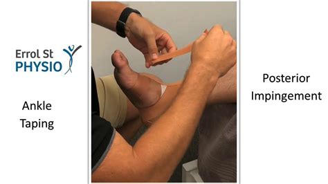 Ankle Taping Posterior Impingement Youtube