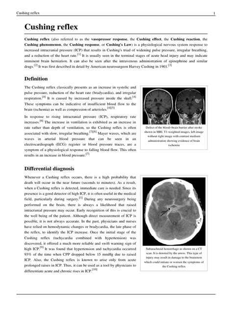 Cushing Reflex | Circulatory System | Cardiovascular Physiology