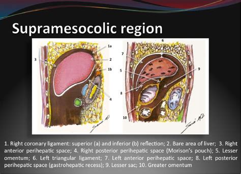 Peritoneal Ligaments And Spaces A Comprehensive Review Semantic Scholar