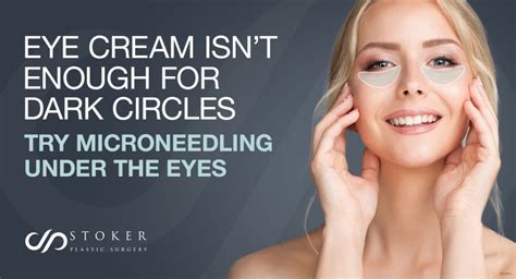 Eye Cream Or Microneedling For Dark Circles Under The Eyes Los