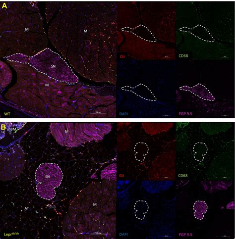 Identification CD68 And DiI Cells Within The Thighs Of WT And