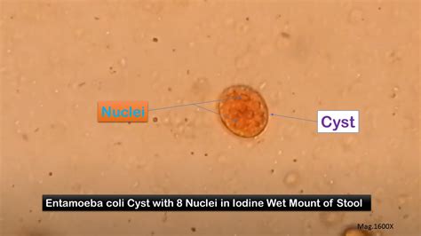 Procedure For Stool Parasite