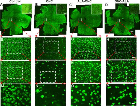 Density Distribution Of Retinal Ganglion Cells Rgcs In Whole Mount