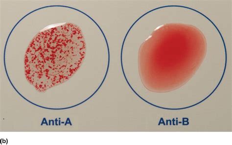 Direct Agglutination Biology Lessons Teaching Biology Technology Life