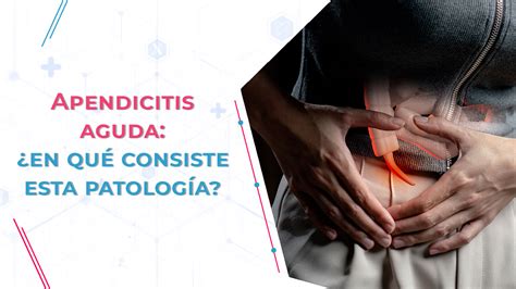 Apendicitis Aguda En Qu Consiste Esta Patolog A