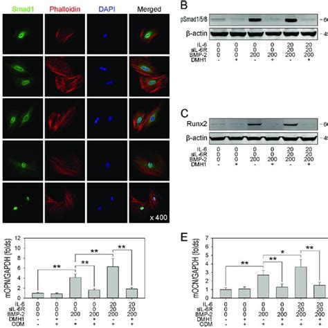 Il Injection Enhances Rhbmp Acs Induced Bone Regeneration And