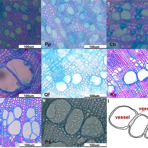 (a–h): Vessel anatomy image used for measuring vessel wall thickness ...