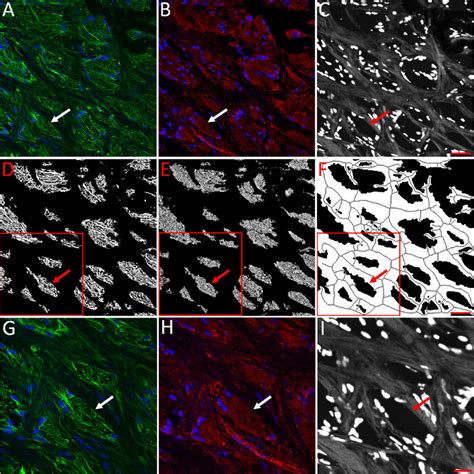 Quantitative Microstructural Analysis Of Cellular And Tissue Remodeling