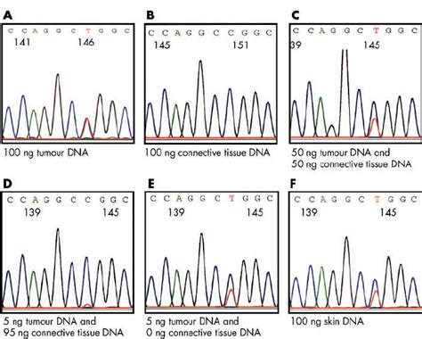 (A) The novel C/T single nucleotide polymorphism (SNP; arrow) at codon ... 