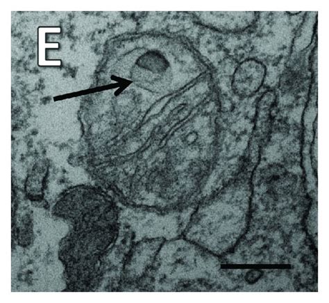 Different Ultrastructural Appearances Of Mitochondria In The Aortic Download Scientific Diagram