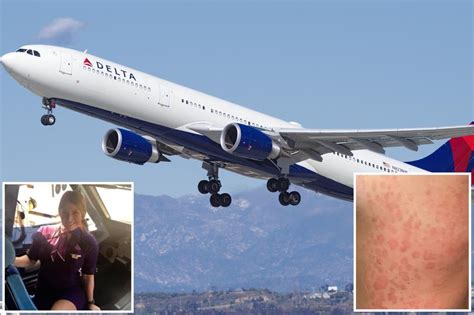 Ex-flight attendant claims Delta Airlines uniform gave her cancer : r/delta