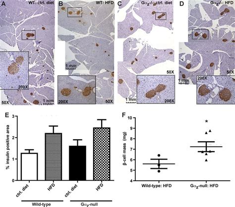 Improved Glucose Tolerance In The Hfd Fed G Z Null Mice May Be Due To