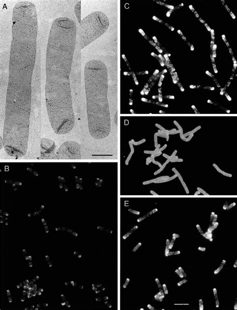 Immunodetection Of D Cys Residues In Sacculi From MC6RP1 Cells Labeled