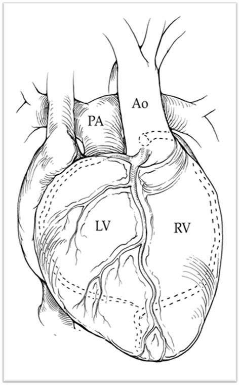 Evolution Of The Surgical Approach To Congenitally Corrected