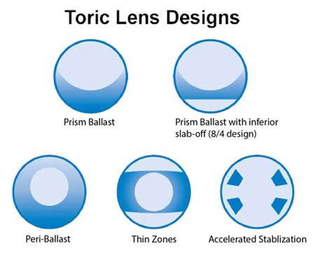 OPSC3113 Outcome 4 Techniques For Fitting Soft Toric Lenses