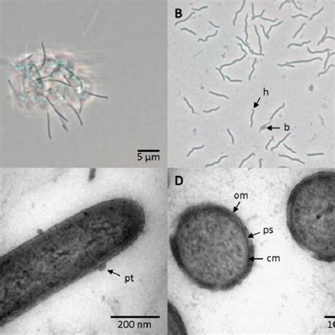 Shape And Ultrastructure Of Cells Of Strain L21 Spi D4 T A Phase Download Scientific