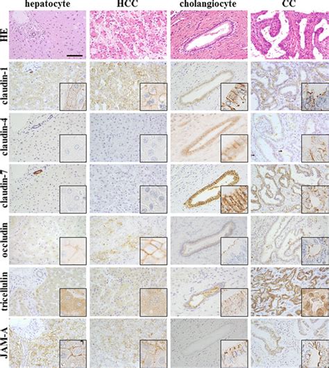 Immunohistochemistry Of Human Liver Samples Immunohistochemical