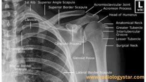 Clavicle - radiologystar