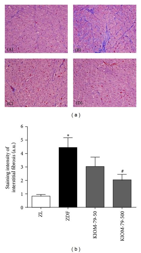 Effect Of Kiom On Cardiac Interstitial Fibrosis A Representative