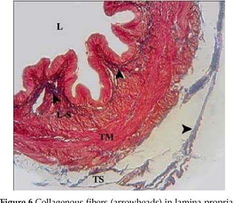 Histology of Extrahepatic Bile Ducts in the Iranian Chukar Partridge (Alectoris Chukar ...