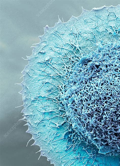 Colorectal Cancer Cell Sem Stock Image C0298593 Science Photo Library