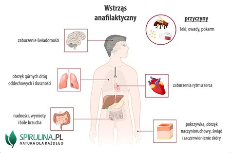 Wstrz S Anafilaktyczny Algi Spirulina I Chlorella