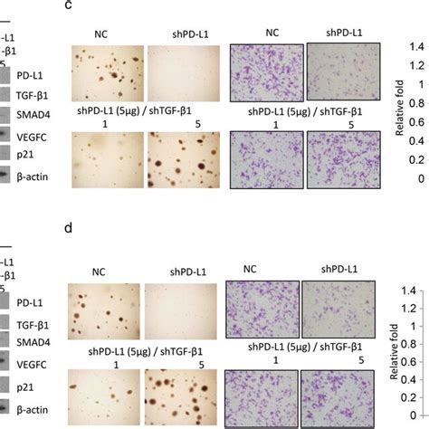 PD‐L1 promotes cell invasiveness and soft agar growth by decreasing ... 