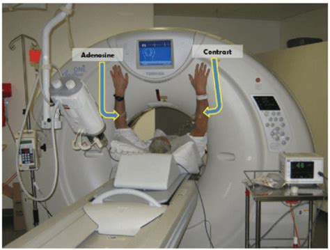 Myocardial Perfusion Imaging Ct Applications Radiology Key