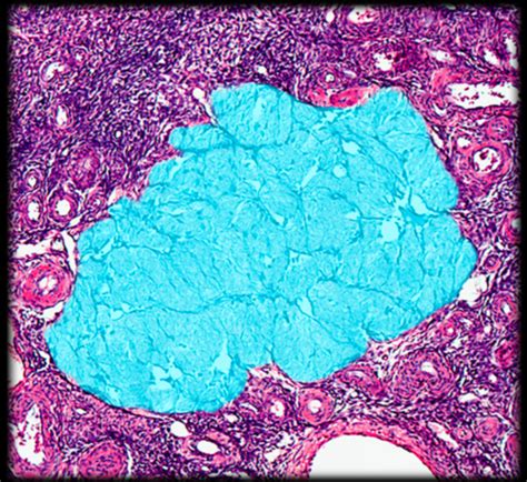 Reproductive System Histology Flashcards Quizlet