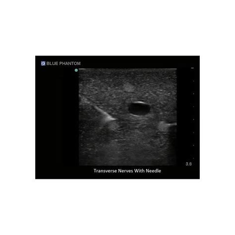 Regional Anaesthesia Ultrasound Training Block Model Adam Rouilly