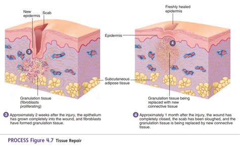 Tissue Repair