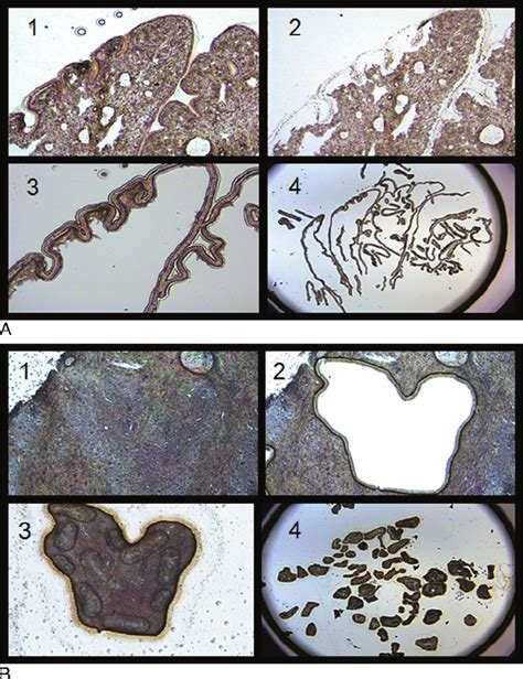 Figure W1 Illustration Of Lcm A Fallopian Tube Tissue 1 Fixed