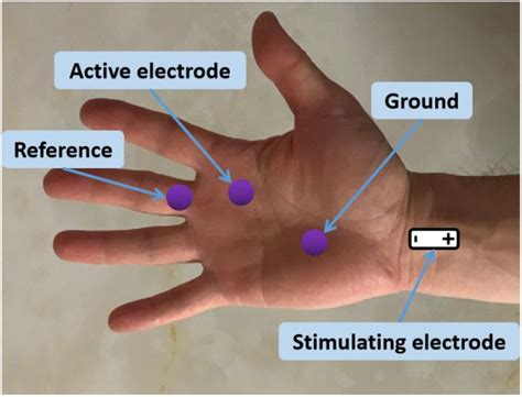 Hand Anatomy Lumbricals | Hot Sex Picture