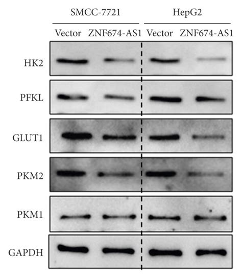 Western Blot Detection Of The Impact Of Overexpression Of Lncrna