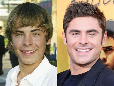 Celebrities Who Have Closed Their Gap Teeth - Business Insider