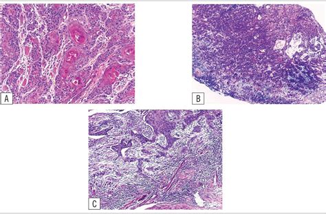 Scielo Brasil Sociodemographic And Clinicopathological Profile Of 80