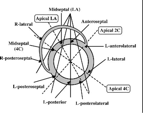 Figure 1 From Detection Of The Earliest Ventricular Contraction Site In