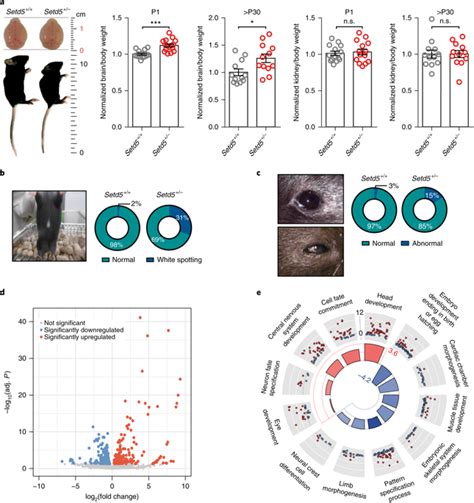 Haploinsufficiency Of The Intellectual Disability Gene Setd5 Disturbs