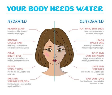 Benefits Of Drinking Water Infographics Body Water Vector Stock Vector