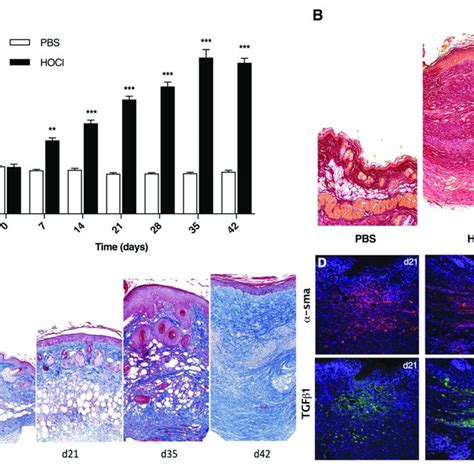 Development Of Skin Fibrosis In HOCl Mice A Skin Thickness From